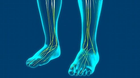 Insoles for extensor tendonitis hot sale