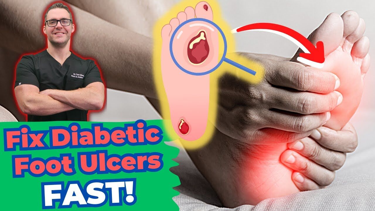 Why You Should Never Ignore Diabetic Foot Ulcers: Arlington/Mansfield Foot  & Ankle Centers: Podiatrists