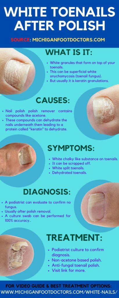 Reason For Skin Growth Under Nails | POPSUGAR Beauty