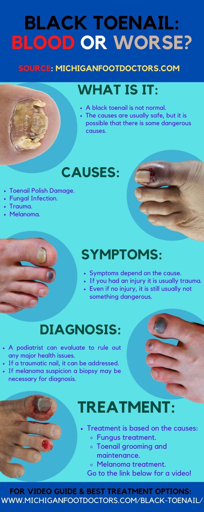 Toenail & Skin Problems | Podiatrist Enfield & South Windsor, CT —  PodiatryCare, P.C. and the Heel Pain Center