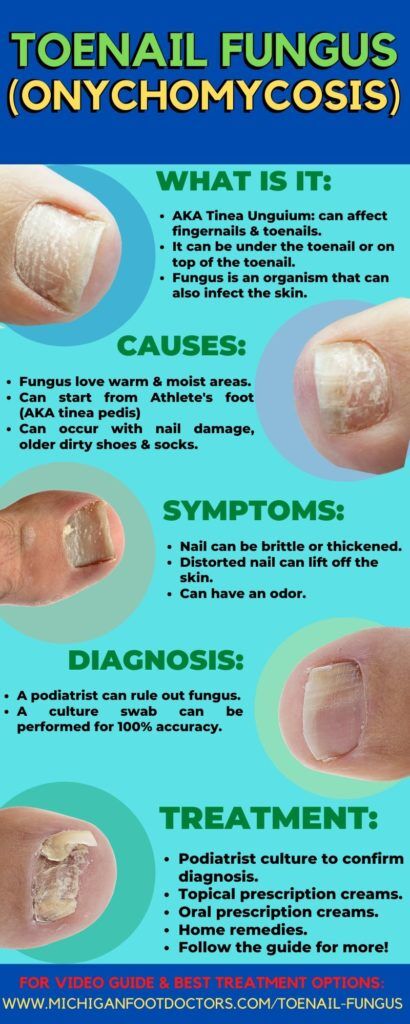 Facts You Should Know About Toenail Fungus - Heartland Foot & Ankle